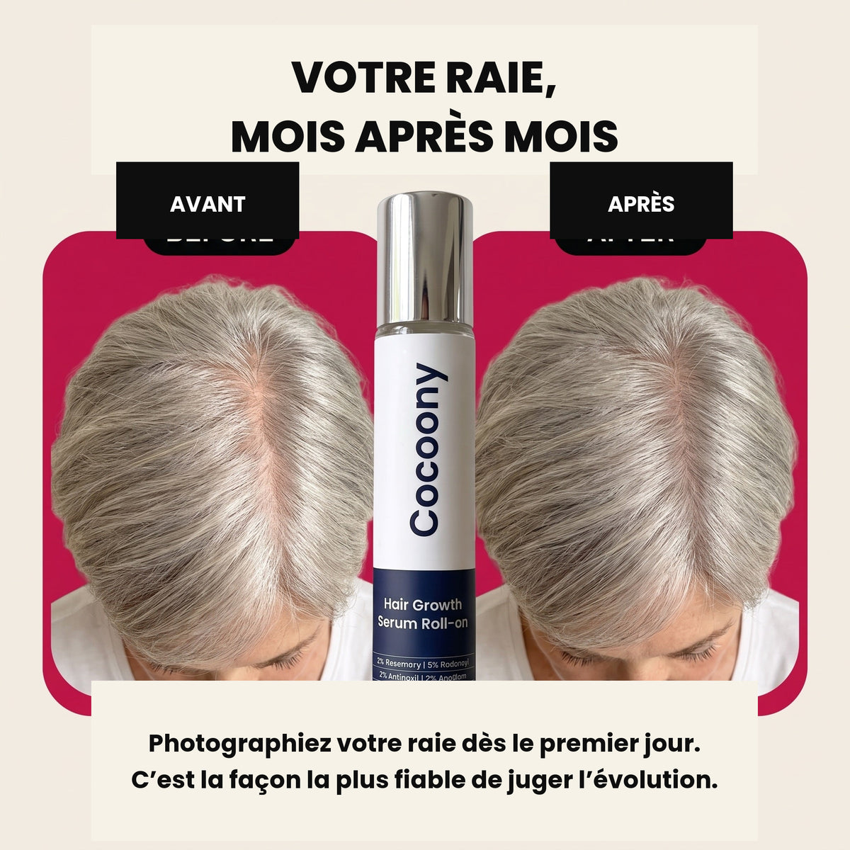 Sérum repousse et densité capillaire Cocoony — visuel 5