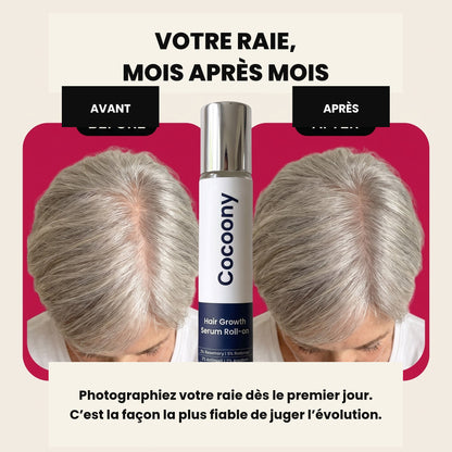 Sérum repousse et densité capillaire Cocoony — visuel 5
