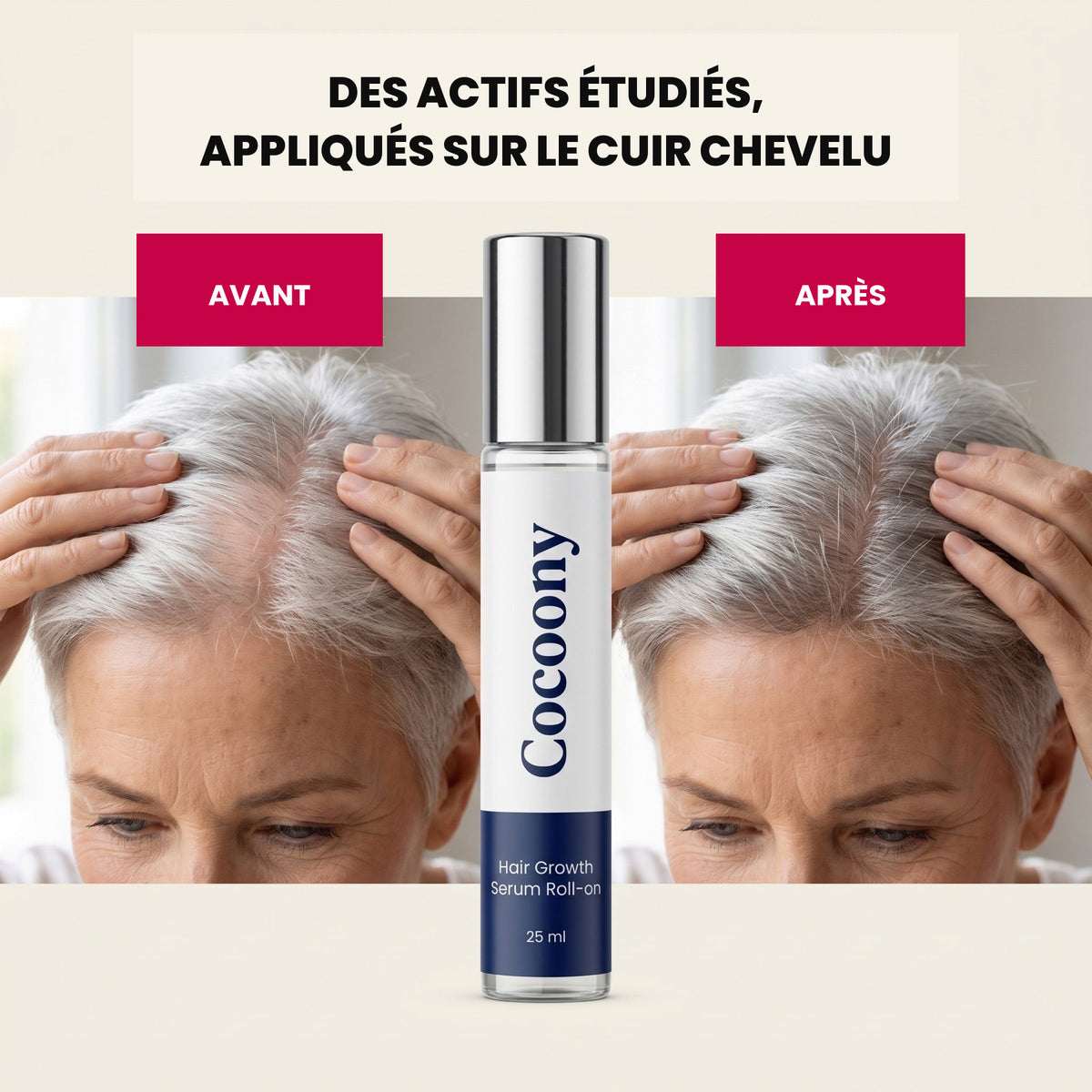 Sérum repousse et densité capillaire Cocoony — visuel 6