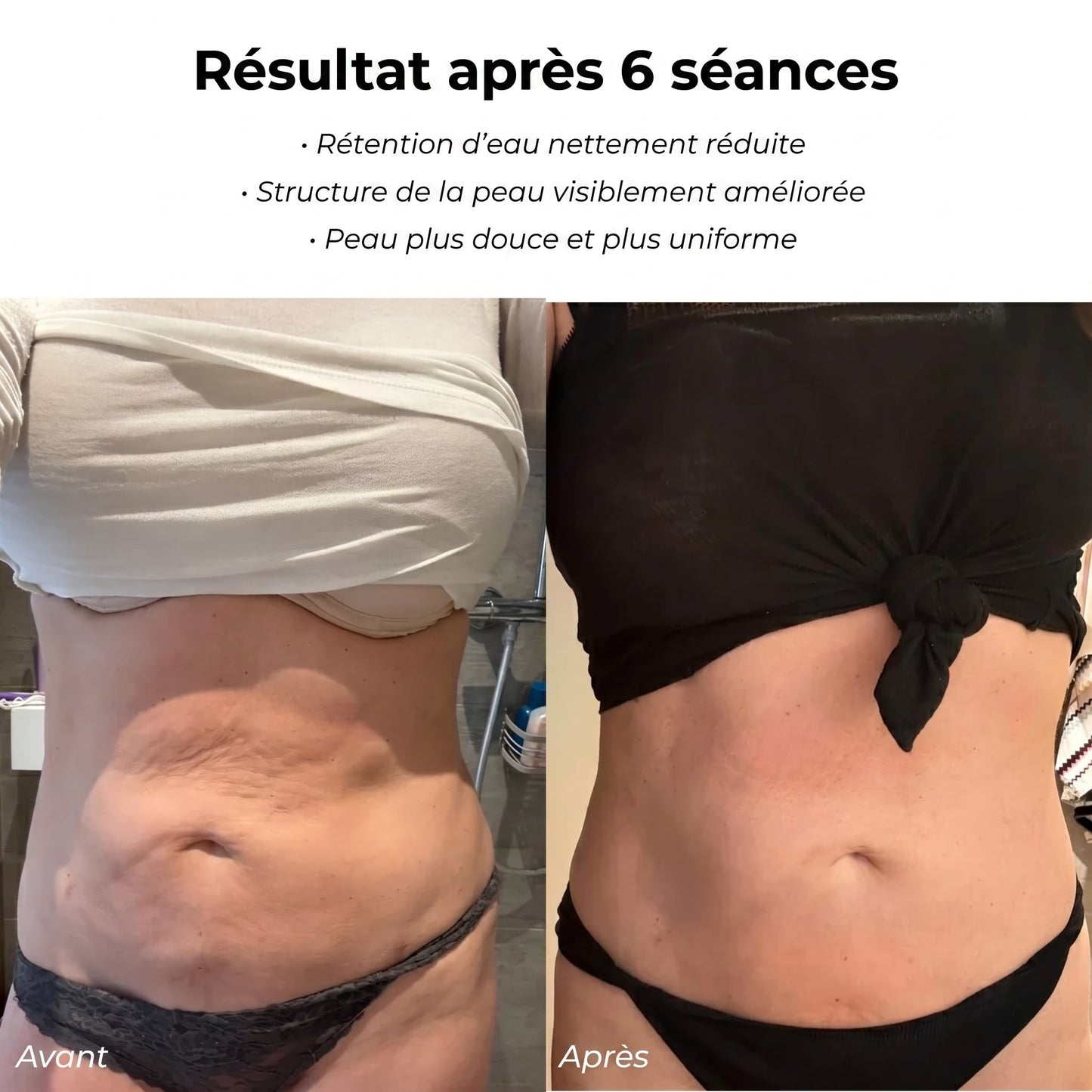 Celluviaa – une peau lisse en 14 jours