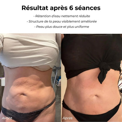 Celluviaa – une peau lisse en 14 jours